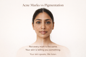 Acne Marks vs Pigmentation — What Your Skin Is Really Showing