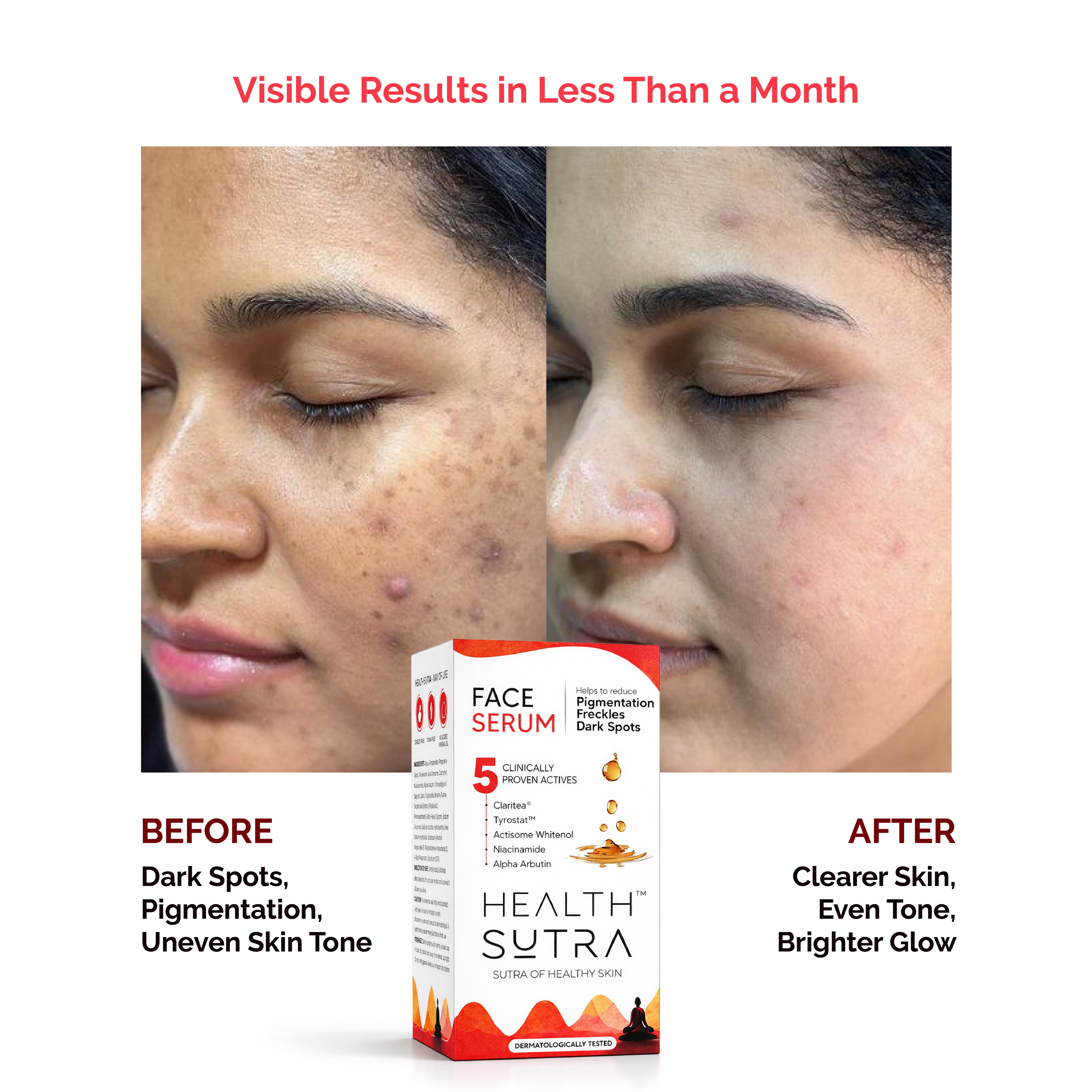 Face Serum with Claritea® for Pigmentation & Dark Spots | 30ml