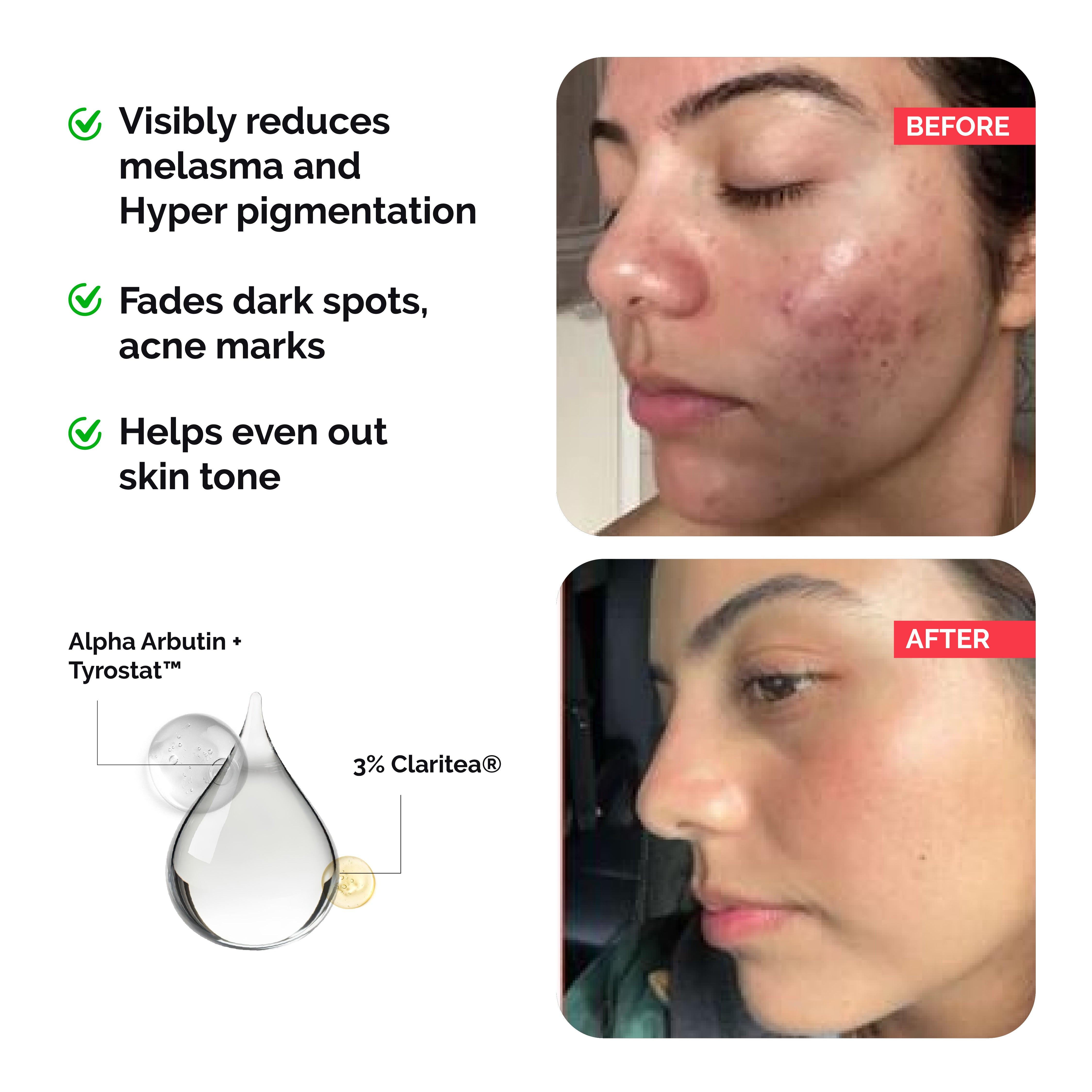 Face Serum with Claritea® for Pigmentation & Dark Spots | 30ml