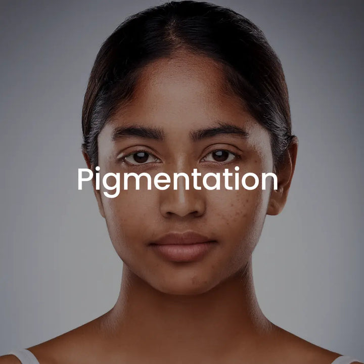 Pigmentation