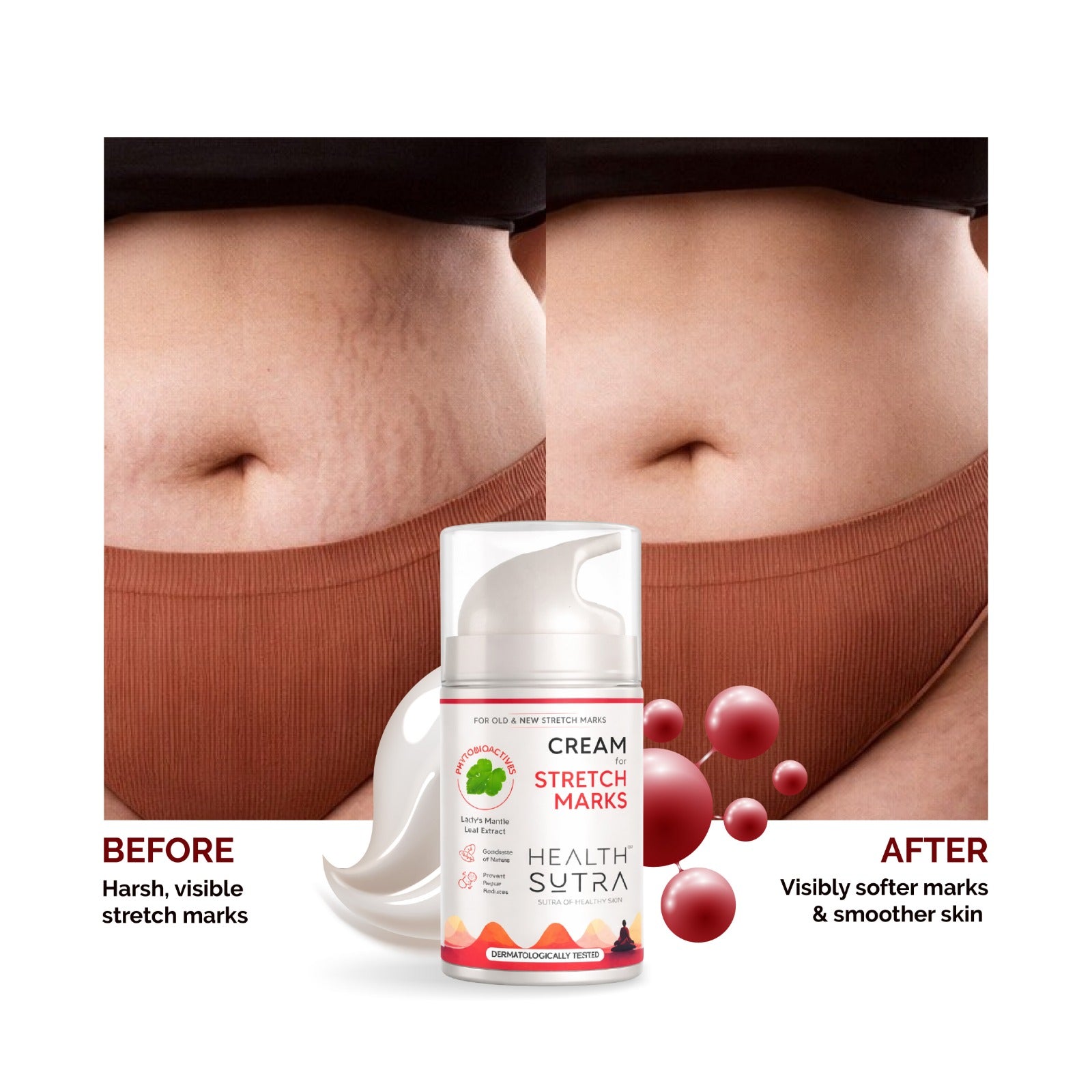 Stretch Marks Cream for Red & White Stretch Marks, Nourishing & Moisturizing Formula (50 gm)