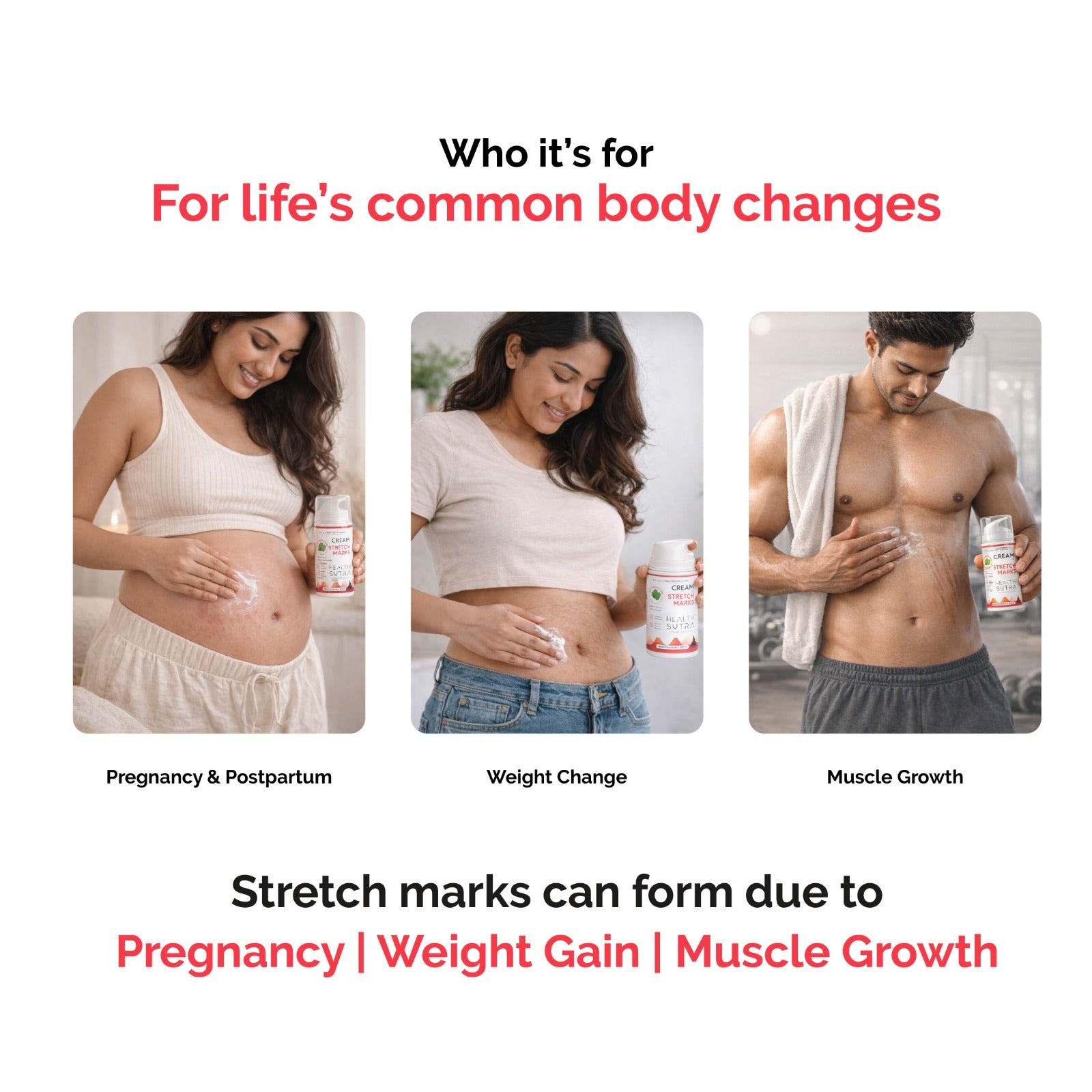 Stretch Marks Cream for Red & White Stretch Marks, Nourishing & Moisturizing Formula (50 gm)